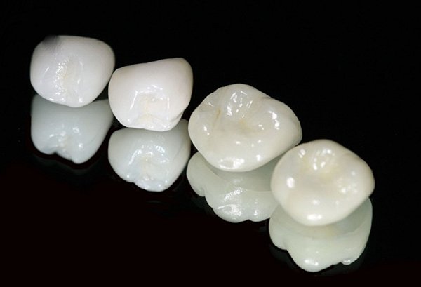 Dấu hiệu nhận biết được răng sứ Zirconia