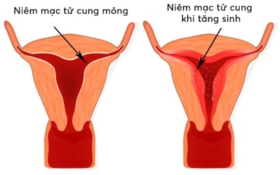 Thuốc kích trứng làm niêm mạc tử cung mỏng